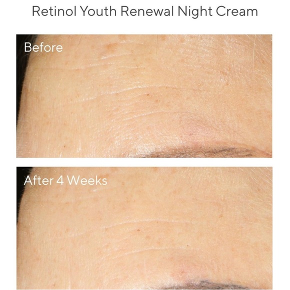 $8β€οΈβπ₯ Murad Retinol Youth Renewal Night Cream π NEW IN BOX - Picture 3 of 8
